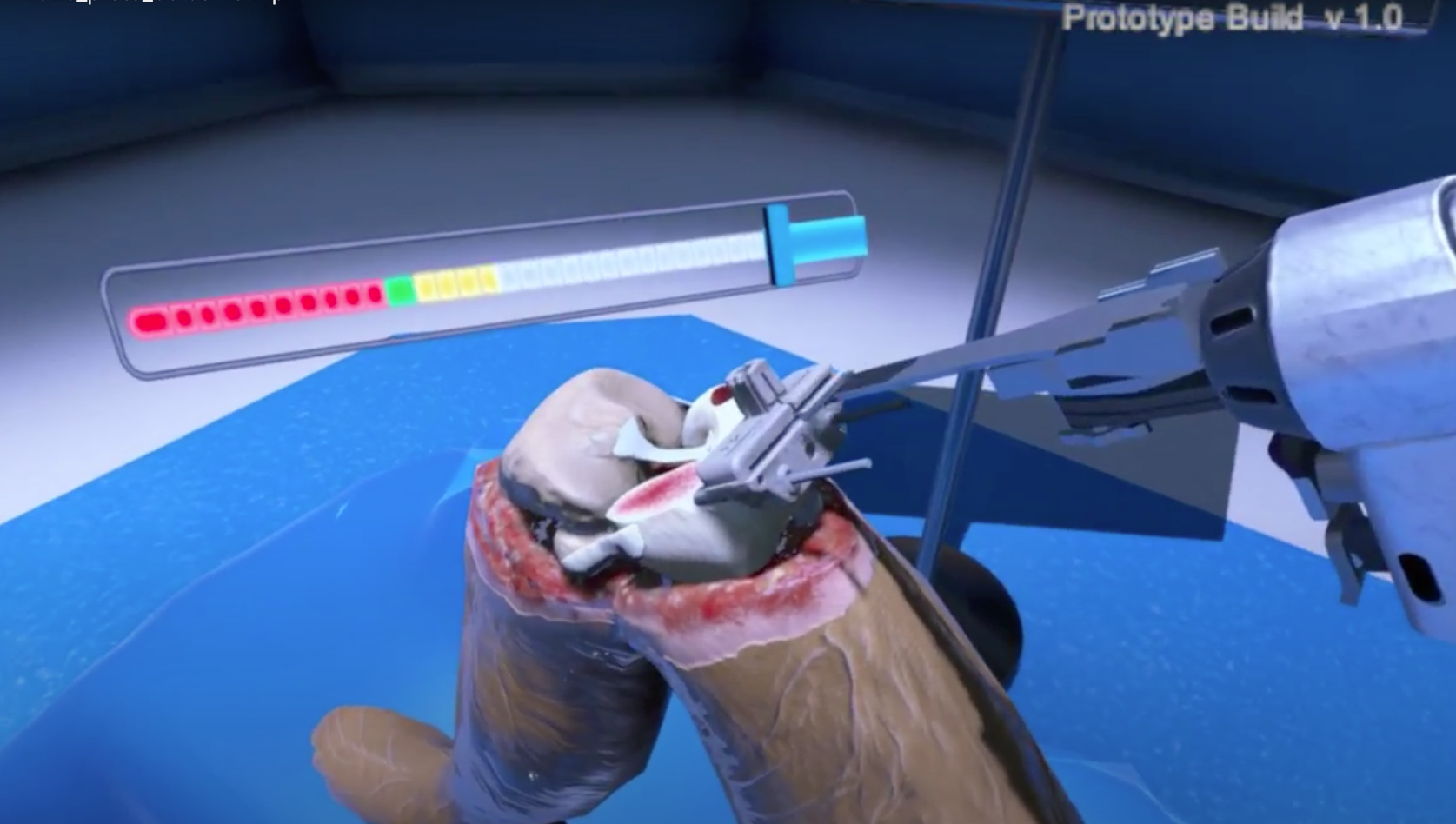 screen shot of a virtual knee surgery
